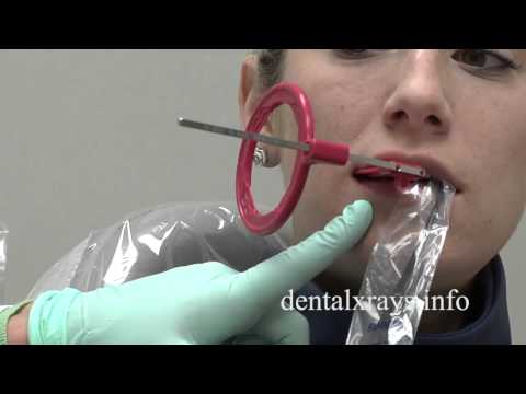 Premolar bitewing positioning tips for dental x-rays